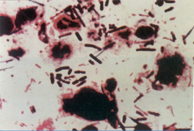 糞便樣品圖片,可見單一的大桿狀細(xì)菌
