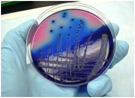 驚爆！耐抗生素細菌的弱點被發現了